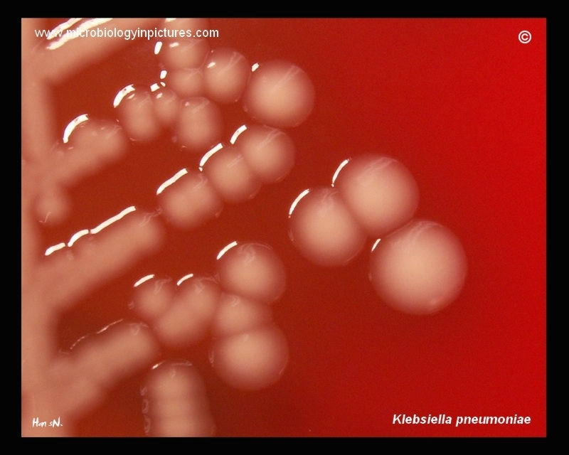 Colonies of K.pneumoniae